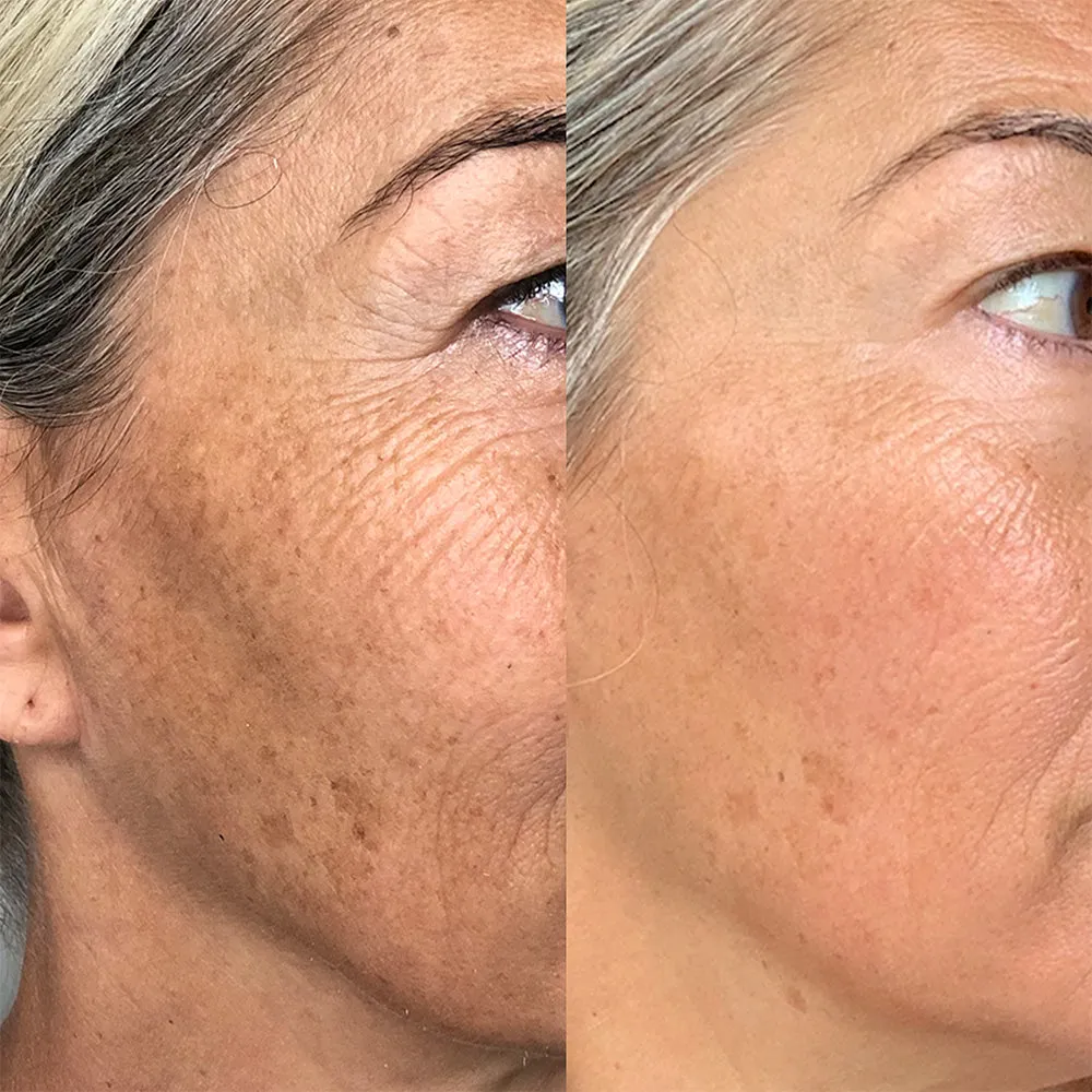 Rapid Dermal Repair | Skin Recovery Kit