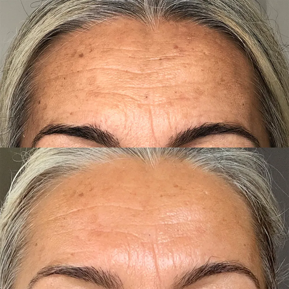 Rapid Dermal Repair | Skin Recovery Kit