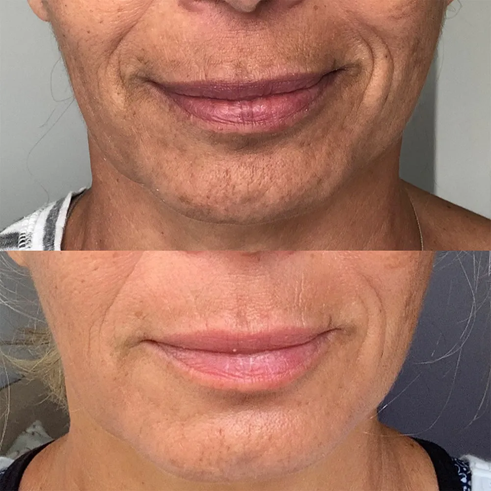 Rapid Dermal Repair | Skin Recovery Kit
